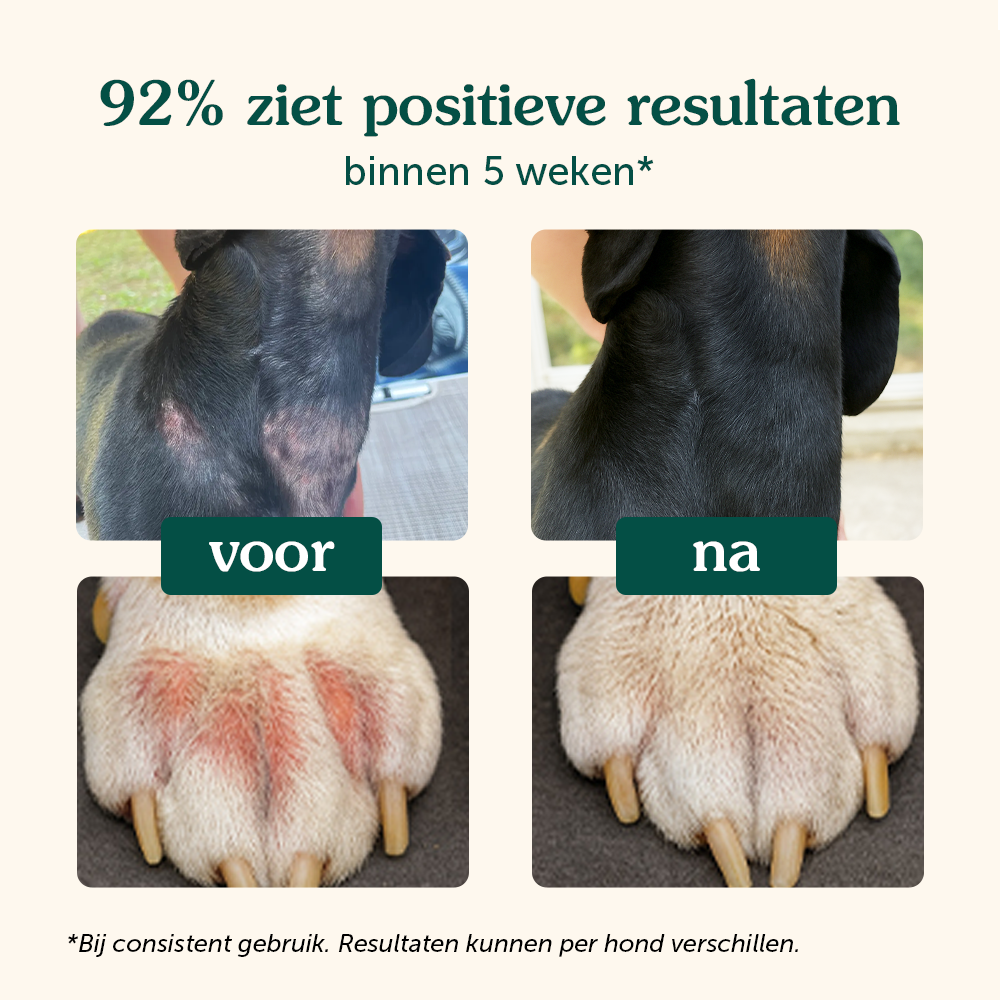 Anti-Jeuk | Ondersteunt immuunsysteem