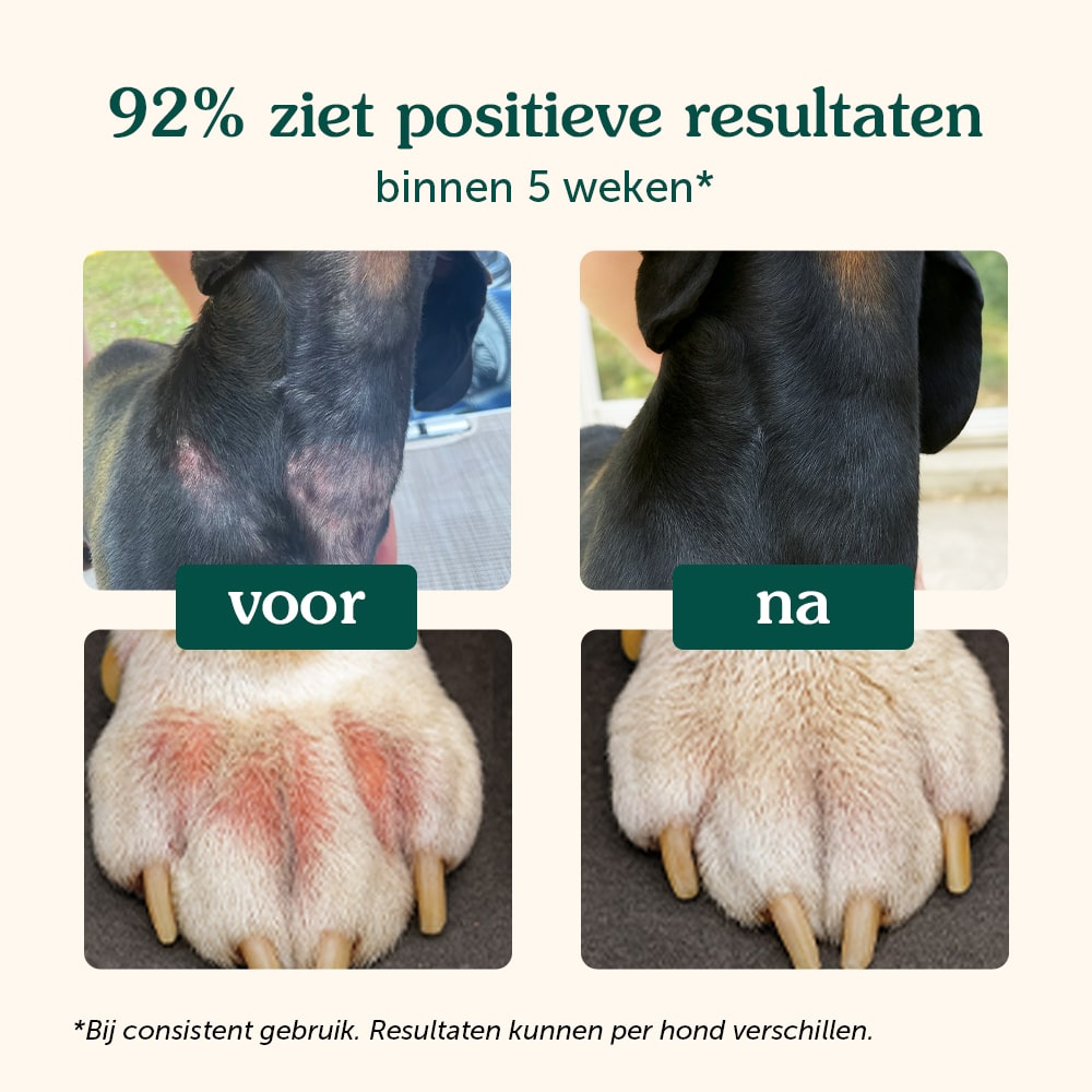 Probiotica | Anti-Jeuk & Darmgezondheid